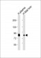 Transferrin Antibody